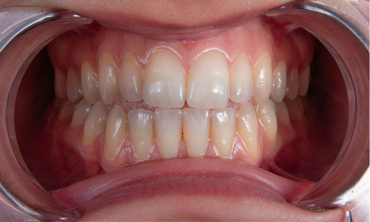 Restorative Dentistry