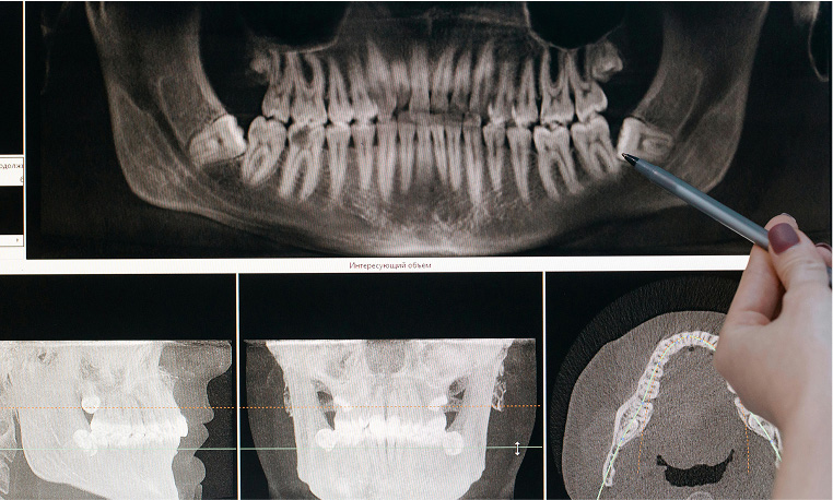 Emergency Dentistry